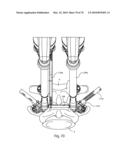 Facet Joint Replacement Instruments and Methods diagram and image