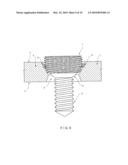 Variable Angle Locked Bone Fixation System diagram and image