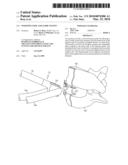 INSERTION TOOL AND GUIDE SYSTEM diagram and image