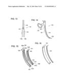 Curvilinear spinal access method and device diagram and image