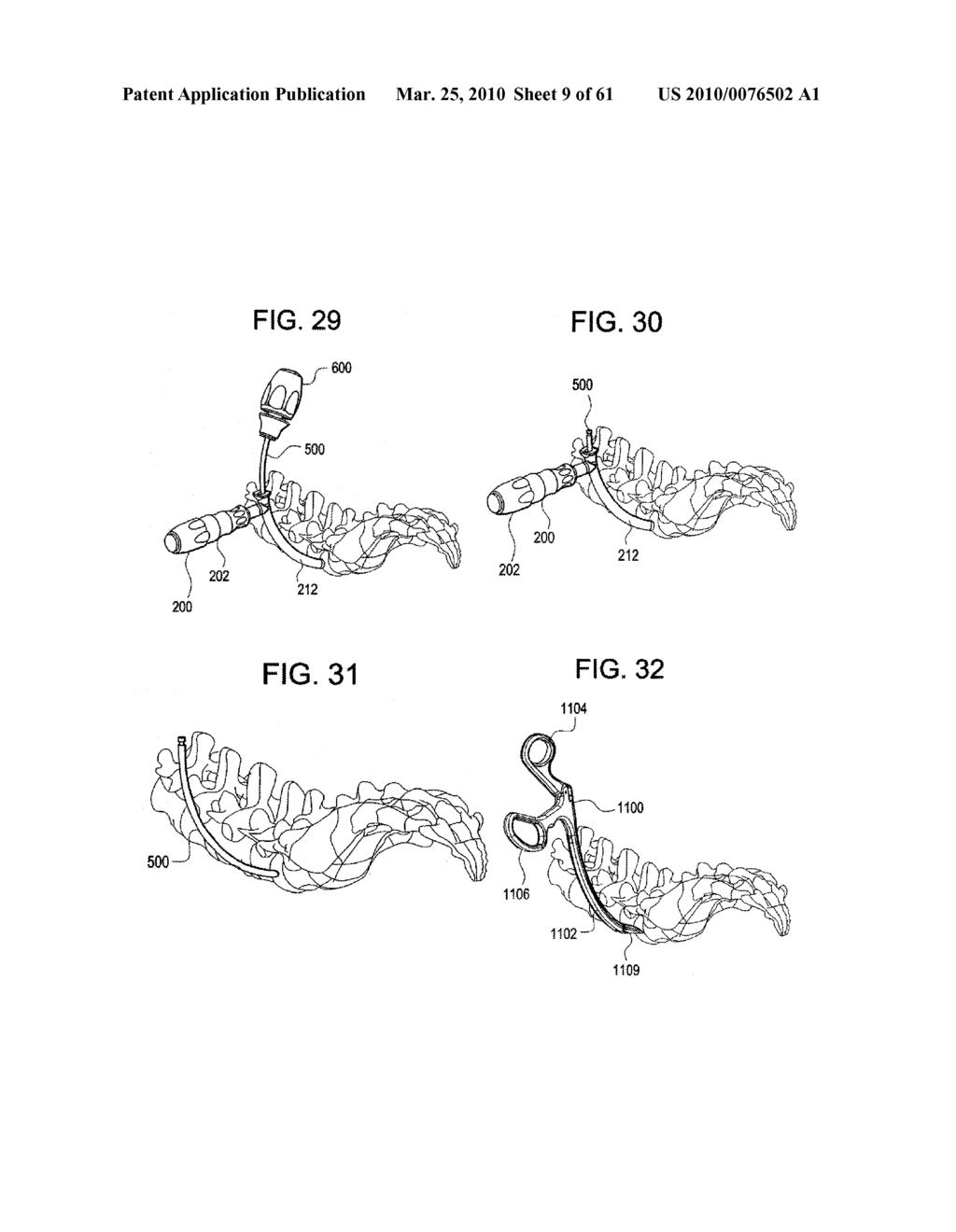 Curvilinear spinal access method and device - diagram, schematic, and image 10