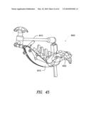 Curvilinear spinal access method and device diagram and image