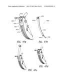 Curvilinear spinal access method and device diagram and image