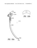 Curvilinear spinal access method and device diagram and image