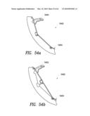 Curvilinear spinal access method and device diagram and image