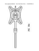 Curvilinear spinal access method and device diagram and image