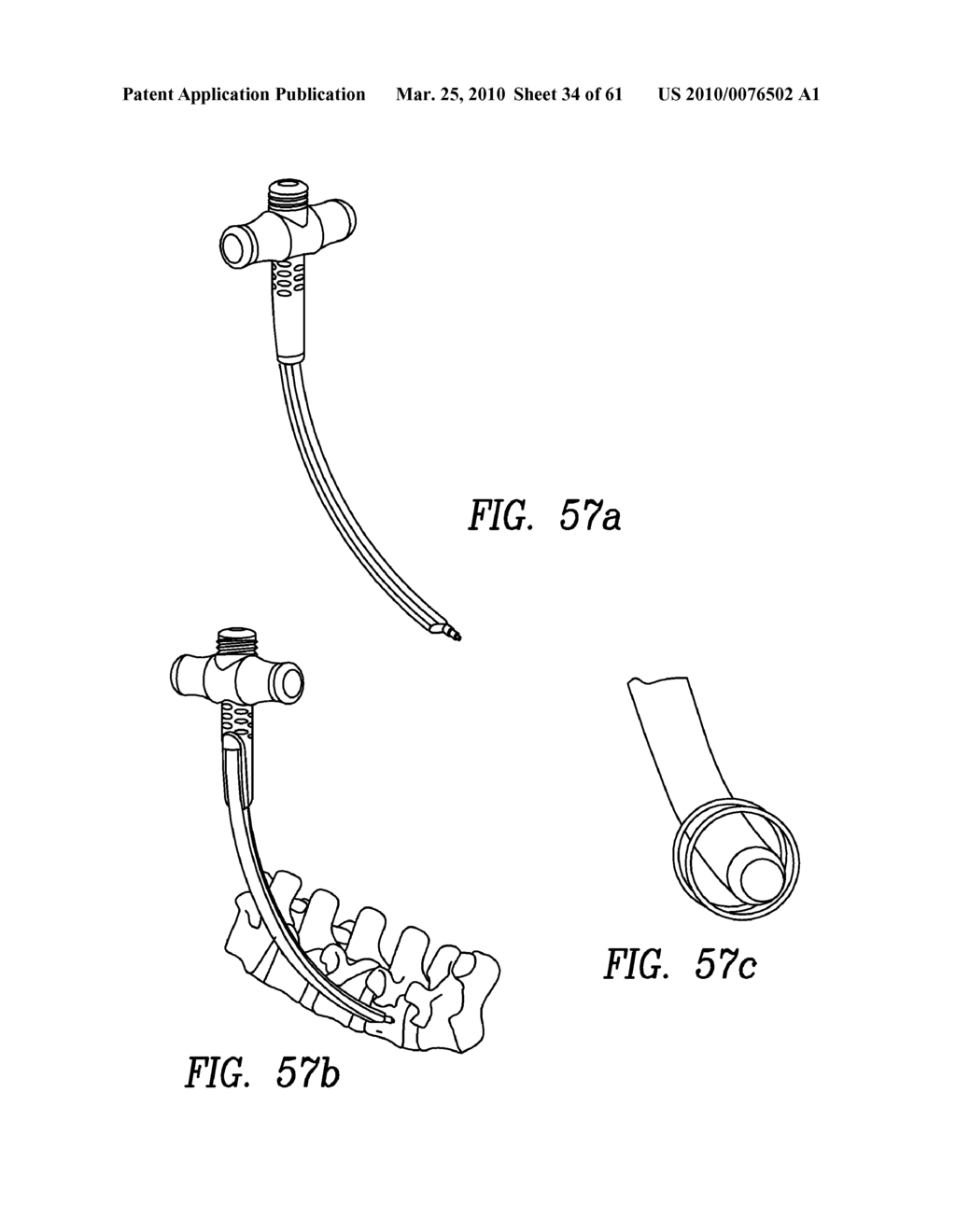 Curvilinear spinal access method and device - diagram, schematic, and image 35