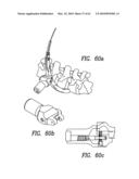 Curvilinear spinal access method and device diagram and image