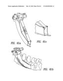 Curvilinear spinal access method and device diagram and image