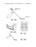 Curvilinear spinal access method and device diagram and image