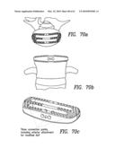 Curvilinear spinal access method and device diagram and image