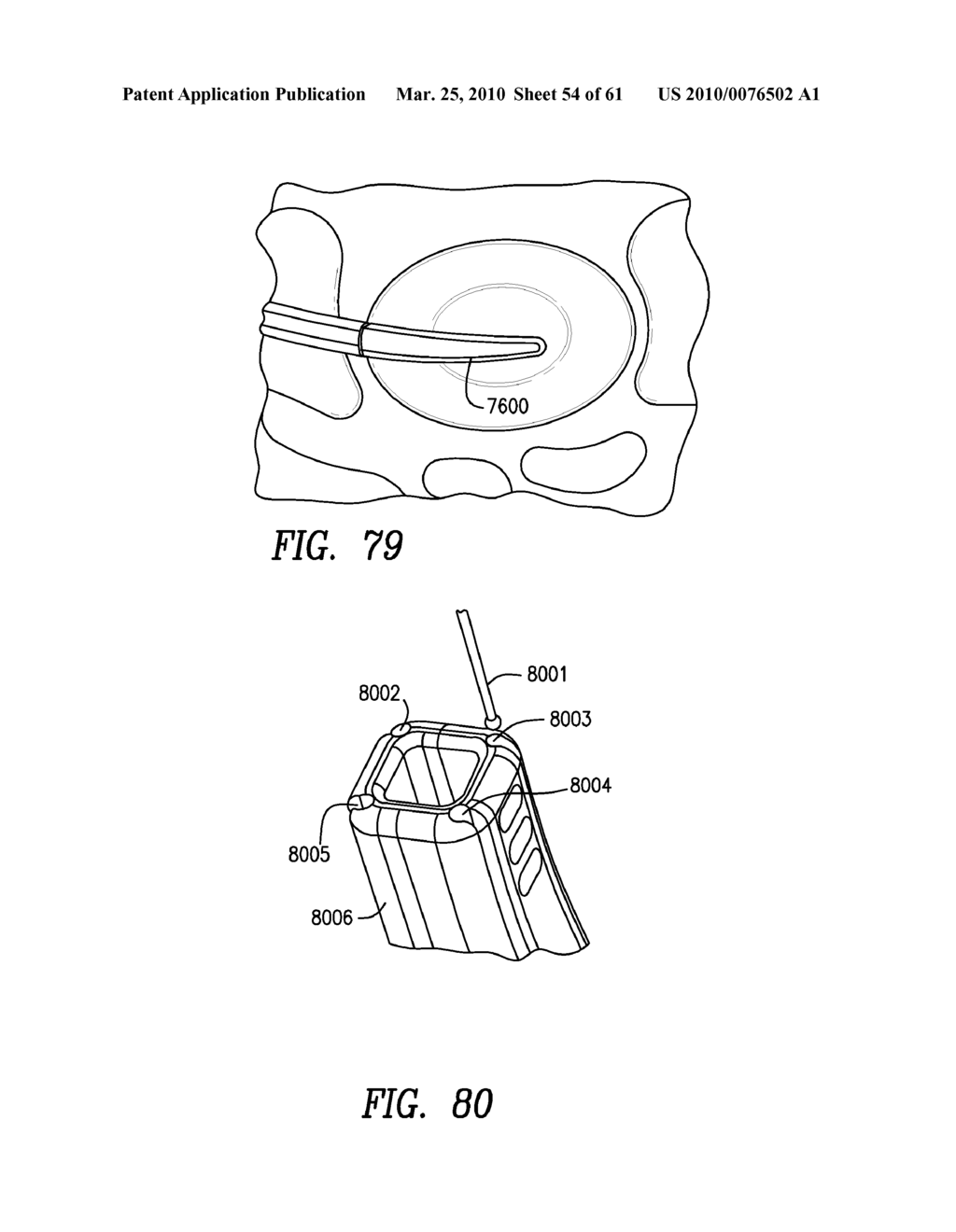 Curvilinear spinal access method and device - diagram, schematic, and image 55