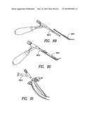 Curvilinear spinal access method and device diagram and image