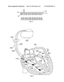 STYRENE-ISOBUTYLENE COPOLYMERS AND MEDICAL DEVICES CONTAINING THE SAME diagram and image