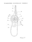 STENT DELIVERY SYSTEM diagram and image