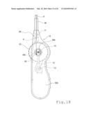 STENT DELIVERY SYSTEM diagram and image