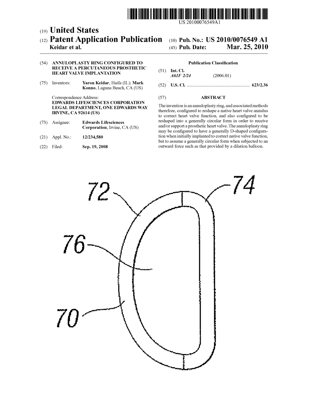 Annuloplasty Ring Configured to Receive a Percutaneous Prosthetic Heart Valve Implantation - diagram, schematic, and image 01