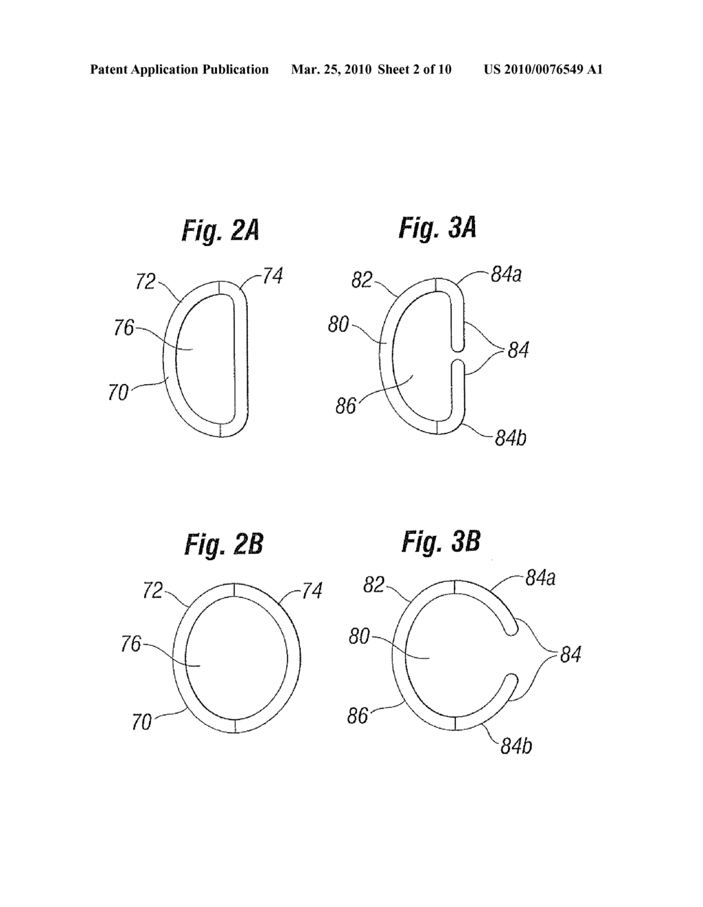 Annuloplasty Ring Configured to Receive a Percutaneous Prosthetic Heart Valve Implantation - diagram, schematic, and image 03