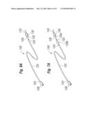 Annuloplasty Ring Configured to Receive a Percutaneous Prosthetic Heart Valve Implantation diagram and image