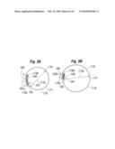 Annuloplasty Ring Configured to Receive a Percutaneous Prosthetic Heart Valve Implantation diagram and image