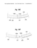 Annuloplasty Ring Configured to Receive a Percutaneous Prosthetic Heart Valve Implantation diagram and image