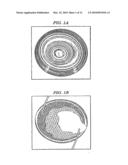 Light Adjustable Multifocal Lenses diagram and image