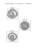 Light Adjustable Multifocal Lenses diagram and image