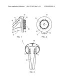 SET OF ELEMENTS TO BE ASSEMBLED IN ORDER TO FORM A SHOULDER PROSTHESIS diagram and image