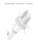 PROSTHETIC WRIST IMPLANT diagram and image