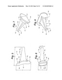 PROSTHETIC WRIST IMPLANT diagram and image