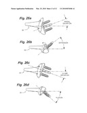 PROSTHETIC WRIST IMPLANT diagram and image