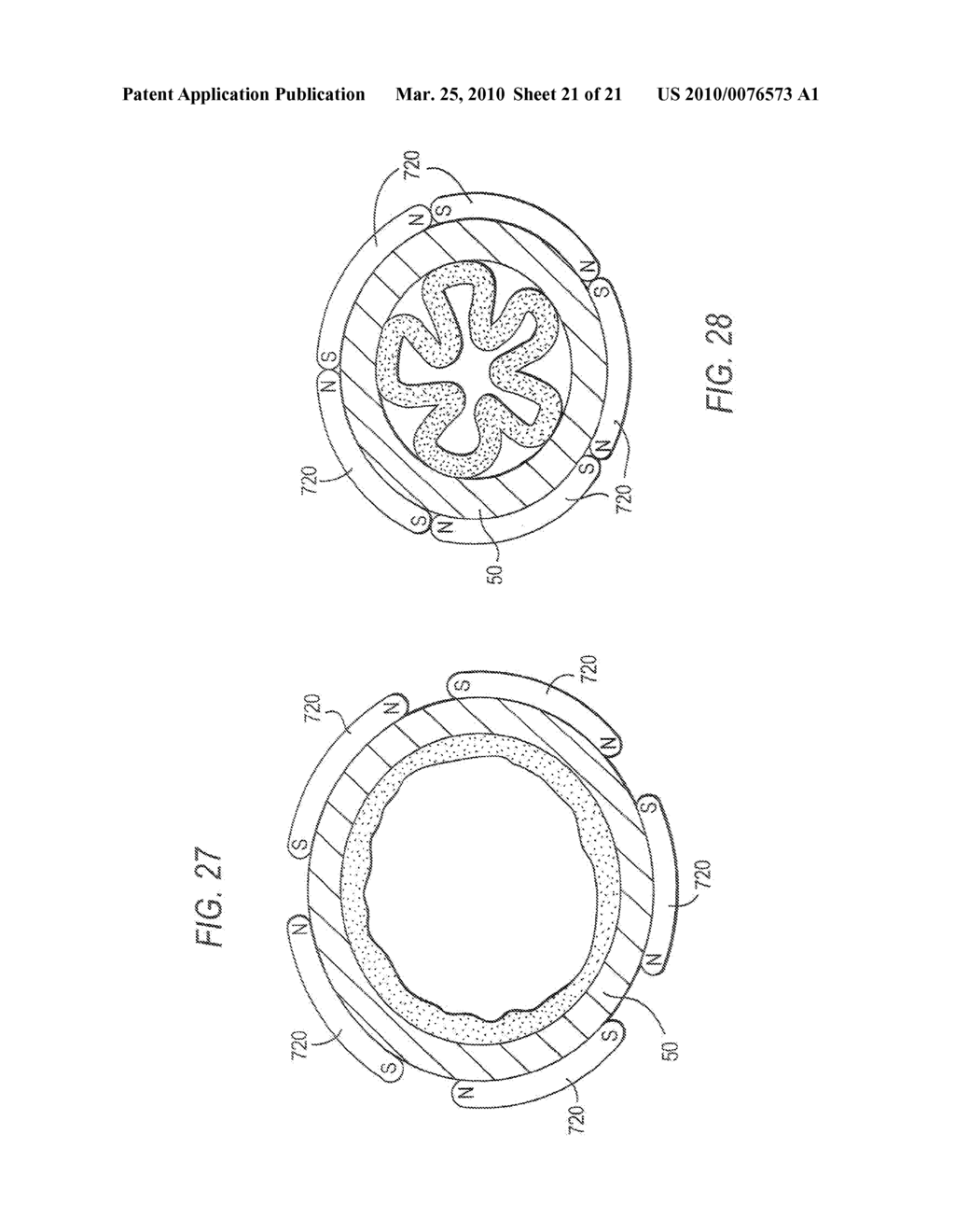 METHODS AND APPARATUS FOR TREATING BODY TISSUE SPHINCTERS AND THE LIKE - diagram, schematic, and image 22