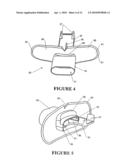 PATIENT INTERFACES diagram and image