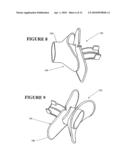 PATIENT INTERFACES diagram and image