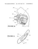 PATIENT INTERFACES diagram and image