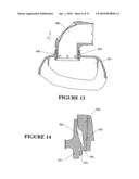 PATIENT INTERFACES diagram and image