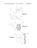 CHUCK REDUCING DEVICE diagram and image