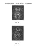 FIBRE TRACKING ON THE BASIS OF MACROSCOPIC INFORMATION diagram and image