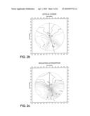 OPTHALMIC PROGRESSIVE ADDITION LENS WITH CUSTOMIZED DESIGN FEATURE diagram and image