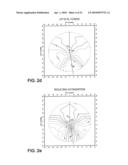 OPTHALMIC PROGRESSIVE ADDITION LENS WITH CUSTOMIZED DESIGN FEATURE diagram and image