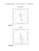 OPTHALMIC PROGRESSIVE ADDITION LENS WITH CUSTOMIZED DESIGN FEATURE diagram and image