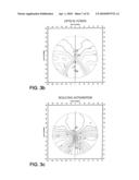 OPTHALMIC PROGRESSIVE ADDITION LENS WITH CUSTOMIZED DESIGN FEATURE diagram and image