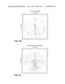 OPTHALMIC PROGRESSIVE ADDITION LENS WITH CUSTOMIZED DESIGN FEATURE diagram and image