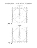 OPTHALMIC PROGRESSIVE ADDITION LENS WITH CUSTOMIZED DESIGN FEATURE diagram and image