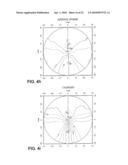 OPTHALMIC PROGRESSIVE ADDITION LENS WITH CUSTOMIZED DESIGN FEATURE diagram and image