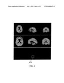 TOOLS FOR AIDING IN THE DIAGNOSIS OF NEURODEGENERATIVE DISEASES diagram and image