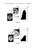 TOOLS FOR AIDING IN THE DIAGNOSIS OF NEURODEGENERATIVE DISEASES diagram and image