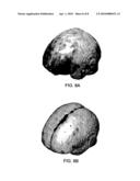 TOOLS FOR AIDING IN THE DIAGNOSIS OF NEURODEGENERATIVE DISEASES diagram and image