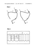 Method and apparatus for registering tomographic volume data records of the intestine diagram and image