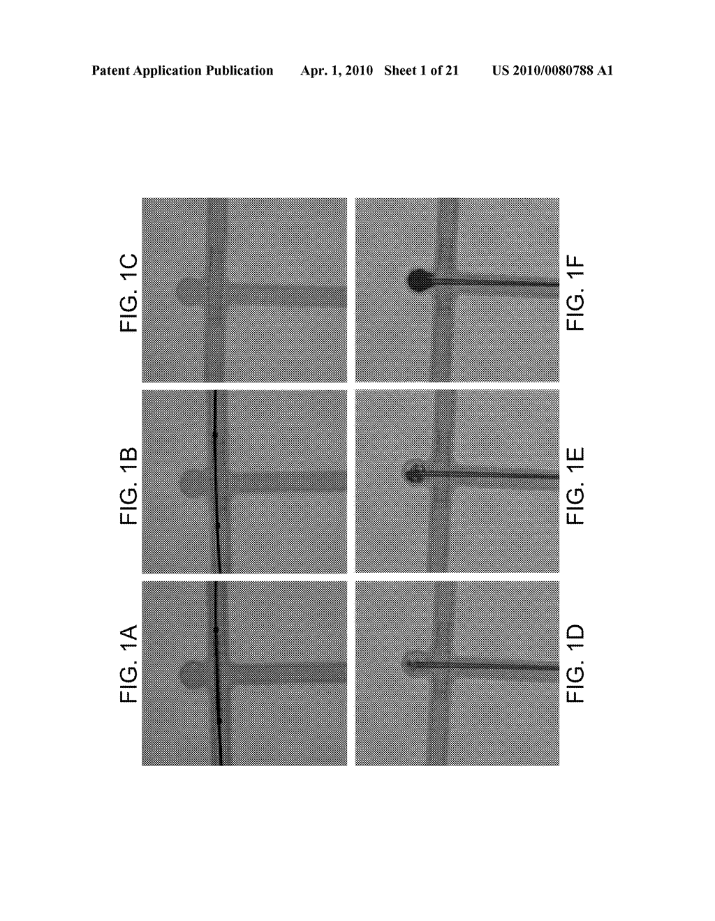 ALGINATE AND ALGINATE LYASE COMPOSITIONS AND METHODS OF USE - diagram, schematic, and image 02